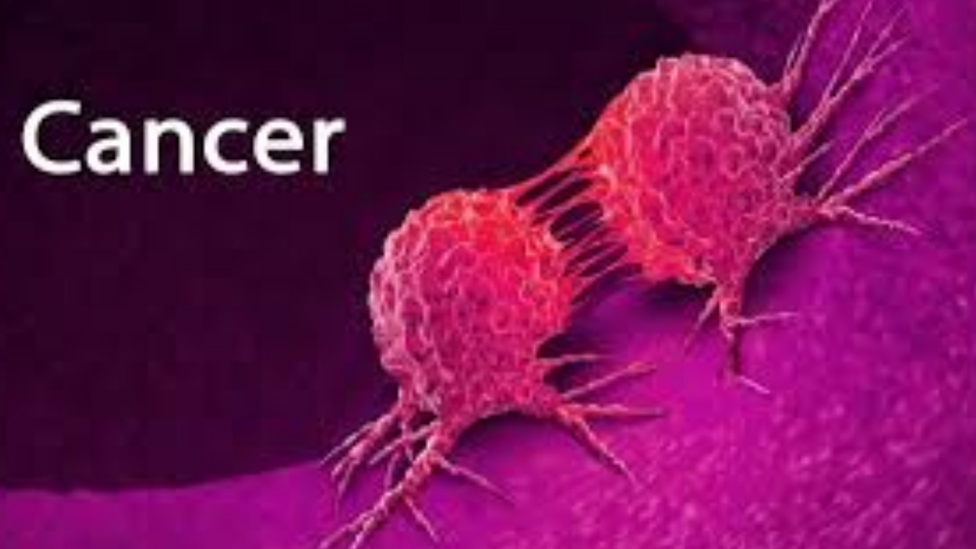 මෙරටින් දිනකට හදුනා ගැනෙන නව පිළිකා රෝගීන් ගැන අනාවරණයක්